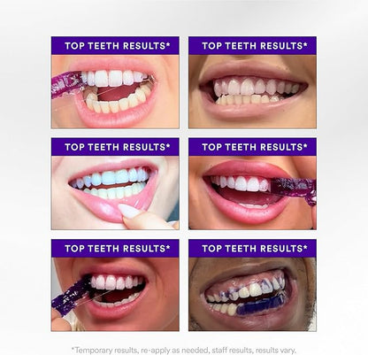 🦷✨ Teeth Whitening Strips Sale — 🔥🔥🔥 Up to 50% OFF