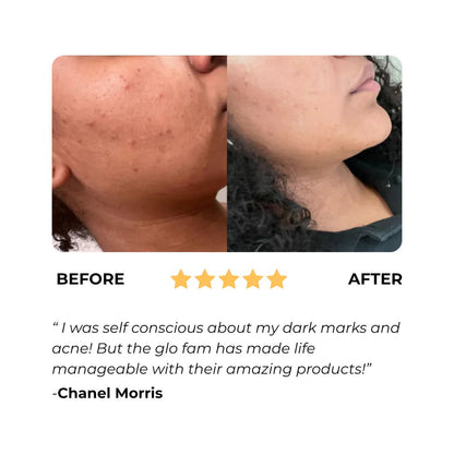 ✨This Week's Special Price $9.99💥Turmeric Brightening Soap