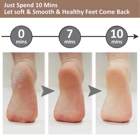 💕👣 Mother’s Day Rechargeable Electric Callus Remover | 3 Speeds F&R Rotation Foot Care