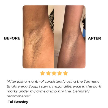 ✨This Week's Special Price $9.99💥Turmeric Brightening Soap