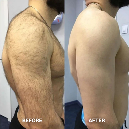 ✨ Gentle Hair Removal Cream for Women & Men – Fast & Painless