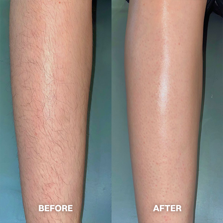 ✨ Gentle Hair Removal Cream for Women & Men – Fast & Painless