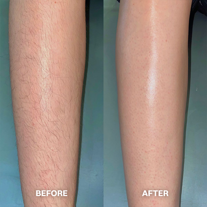✨ Gentle Hair Removal Cream for Women & Men – Fast & Painless