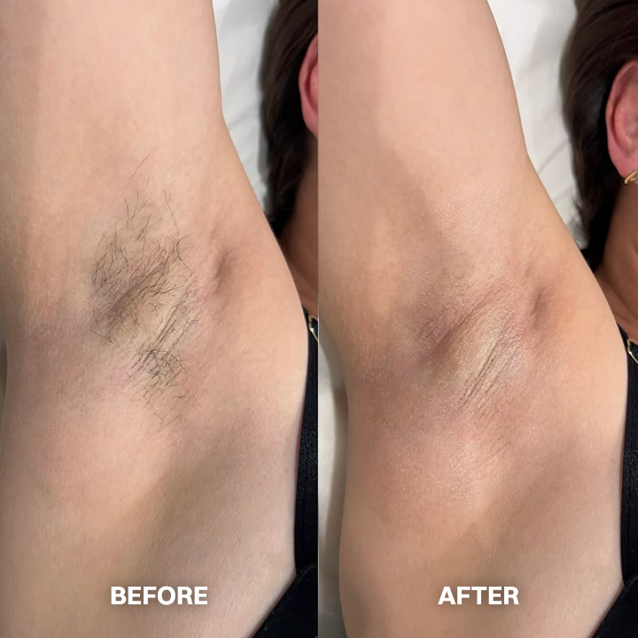 ✨ Gentle Hair Removal Cream for Women & Men – Fast & Painless