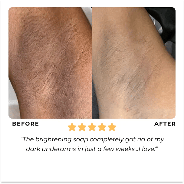 ✨This Week's Special Price $9.99💥Turmeric Brightening Soap