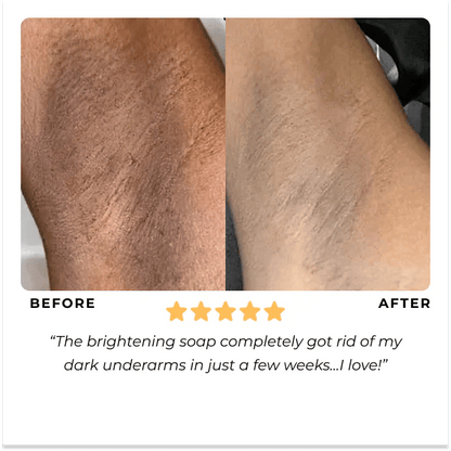 ✨This Week's Special Price $9.99💥Turmeric Brightening Soap