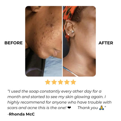 ✨This Week's Special Price $9.99💥Turmeric Brightening Soap